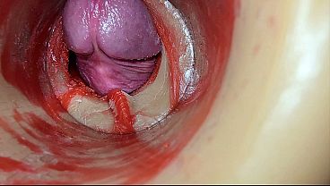 Female Insemination Internal Camera Captures Deep Male Huge Ejaculation Female Insemination Internal Camera Captures Deep Male Huge Ejaculation